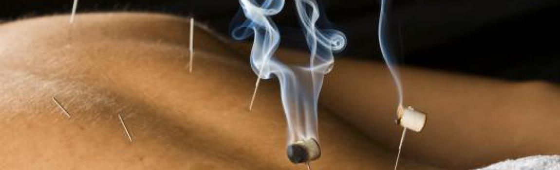 Moxibustion