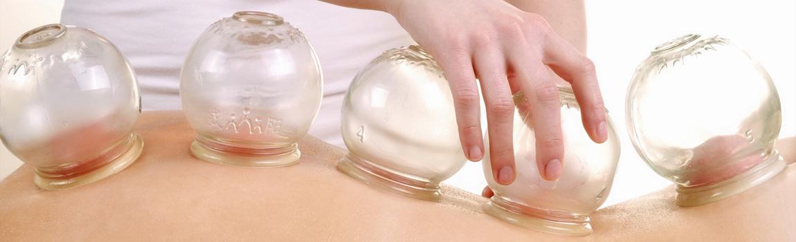 cupping therapy